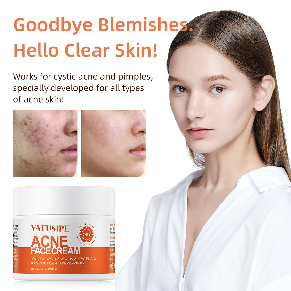 YAFUSIPE applied to a facial blemish demonstrating targeted rapid clearing