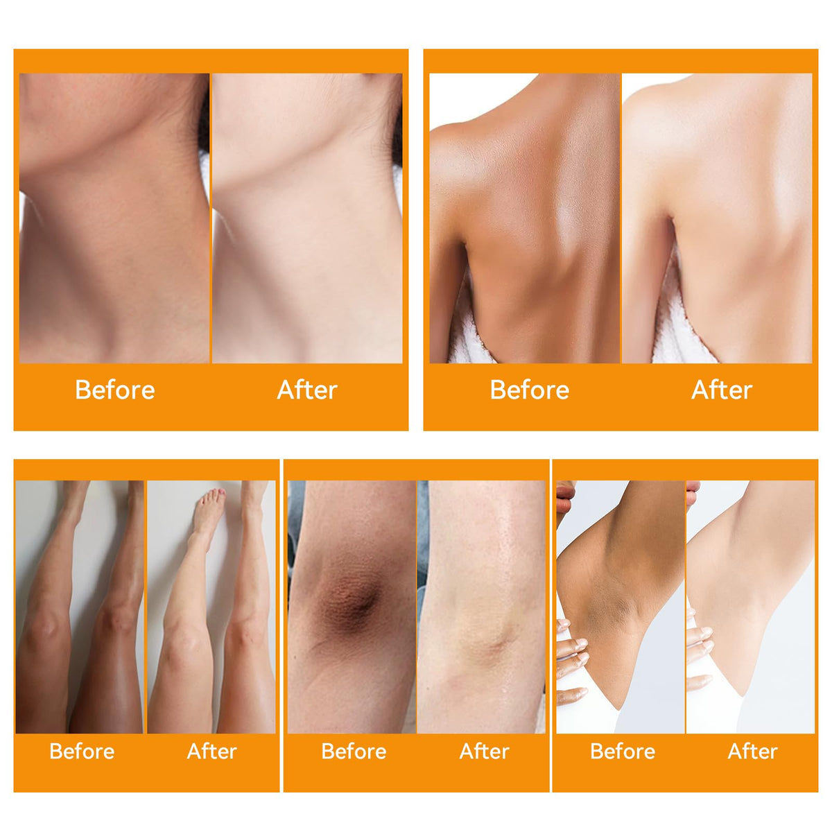 YAFUSIPE cream applied underarm demonstrating gentle protection
