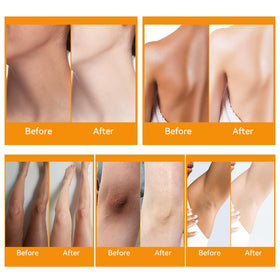 YAFUSIPE cream applied underarm demonstrating gentle protection
