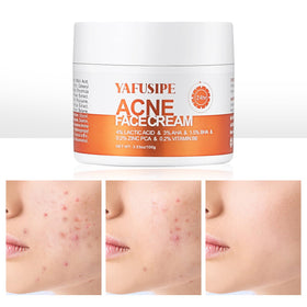 YAFUSIPE front tube acne treatment showing label and packaging for spot control