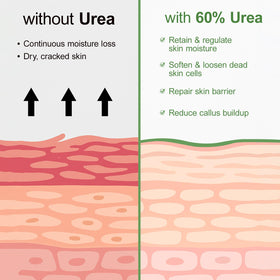 YAFUSIPE label ingredients detail highlighting urea and salicylic acid