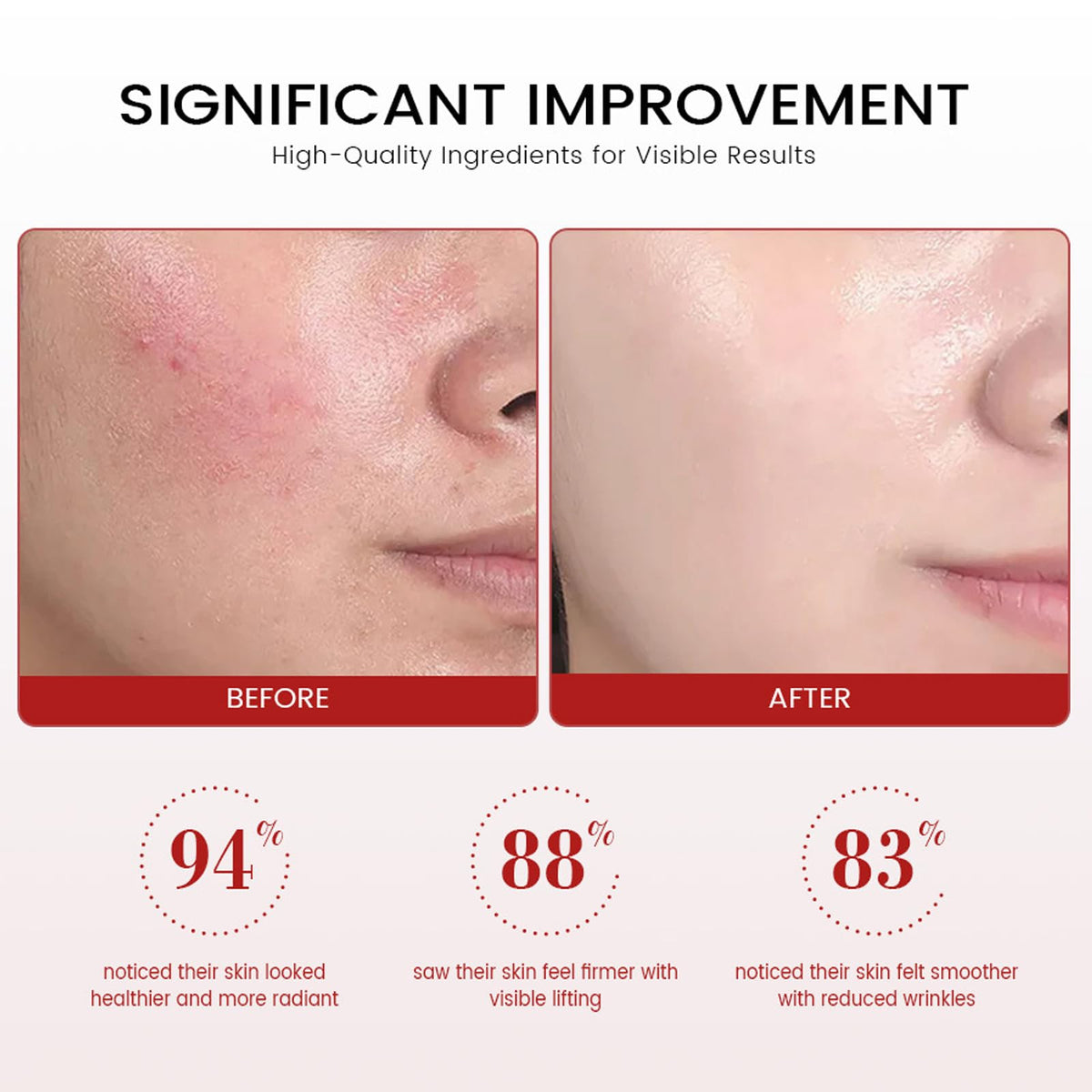 YAKINI Koriderm cream applied on hand demonstrating quick absorption
