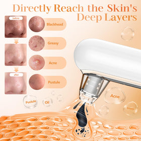 Yccu in use on nose demonstration showing effective blackhead removal benefit