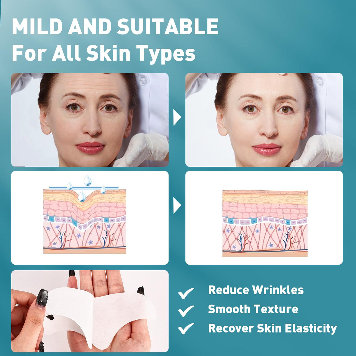 YHOVID open pack with individual adhesive patches visible for convenient single use