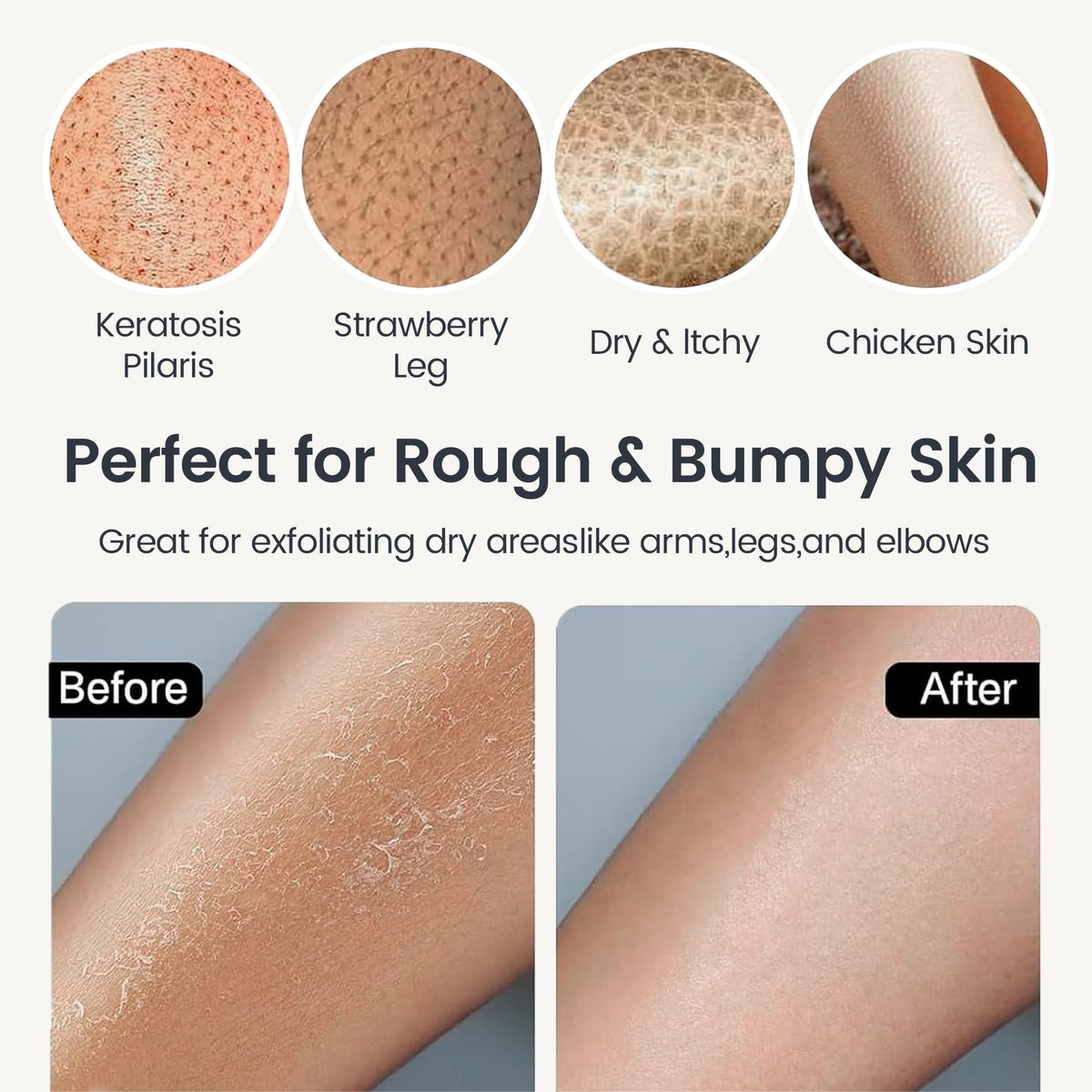Yiclick mitt exfoliating an elbow to reduce rough patches and soften skin