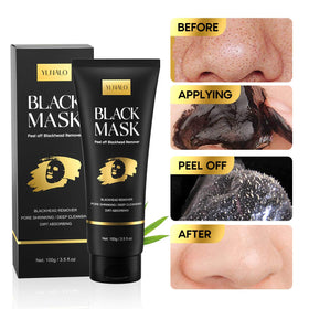YLNALO blackhead extractor tools arranged, precise removal for targeted blemishes