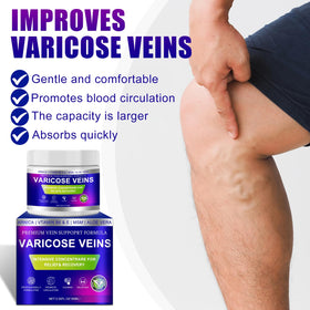 Yongsenina before and after leg photos showing reduced visibility of veins