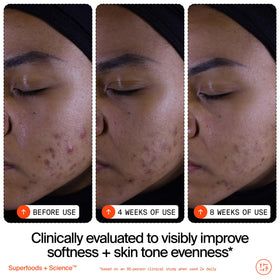 Youth To The People label close-up highlighting vitamin C and AHA+BHA complex benefits
