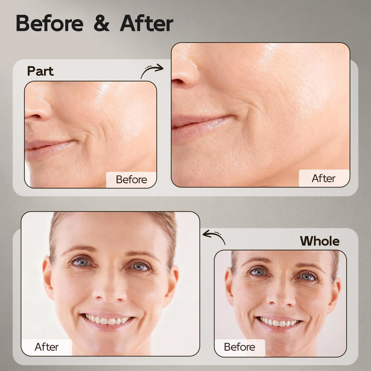 YouthVibe being applied to face and neck for smoother, refined texture
