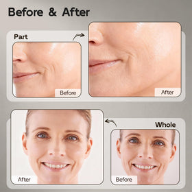 YouthVibe being applied to face and neck for smoother, refined texture