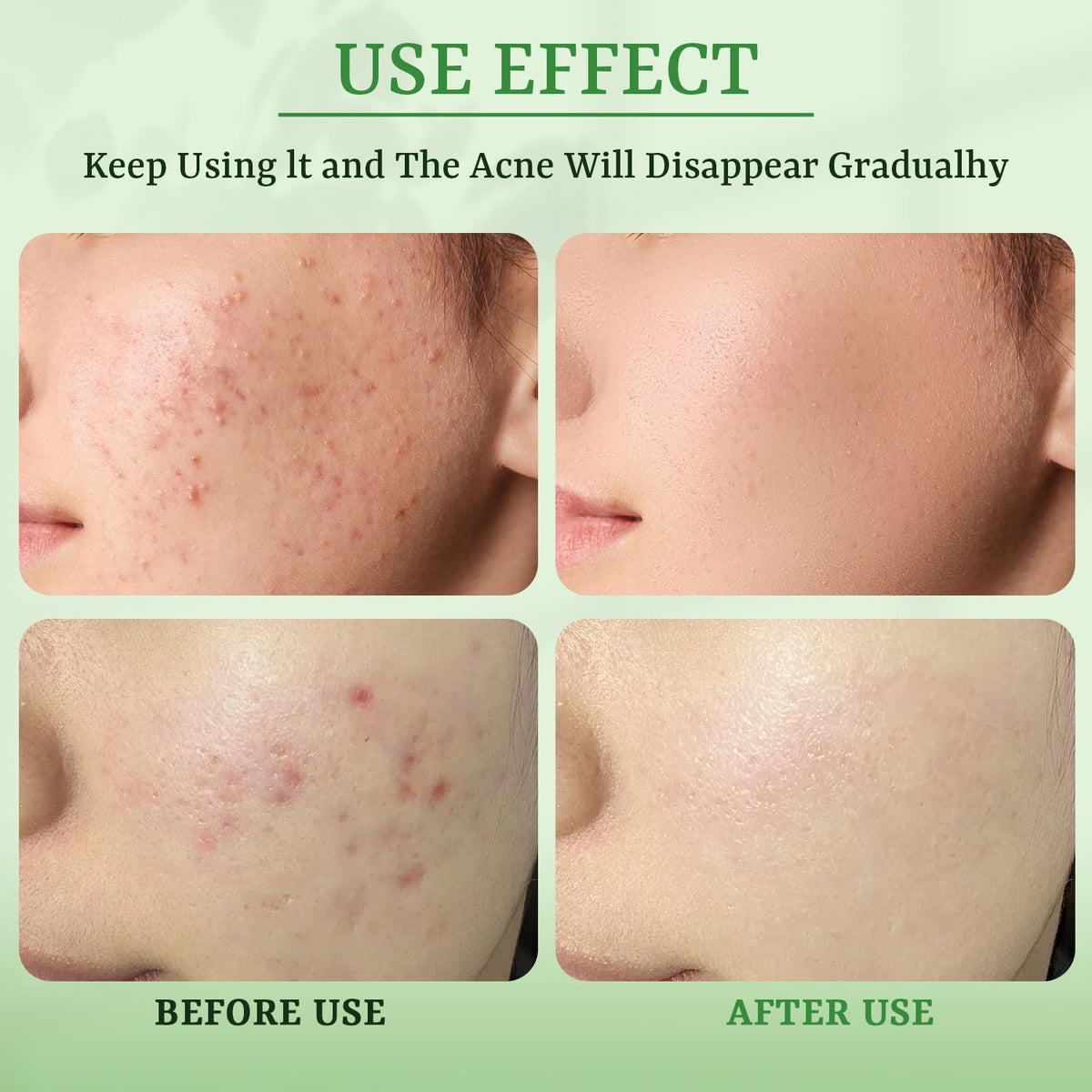 YTRAJU mask staged in bathroom to show easy at-home breakout treatment