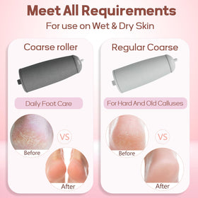 ZABOUL being used on heel demonstrating safe removal of dry skin and smoother results