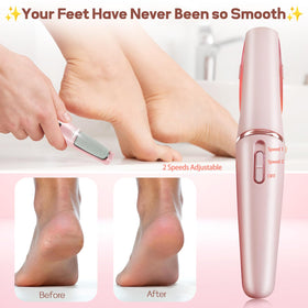 ZABOUL in-hand use demonstrating precise control for safer callus removal