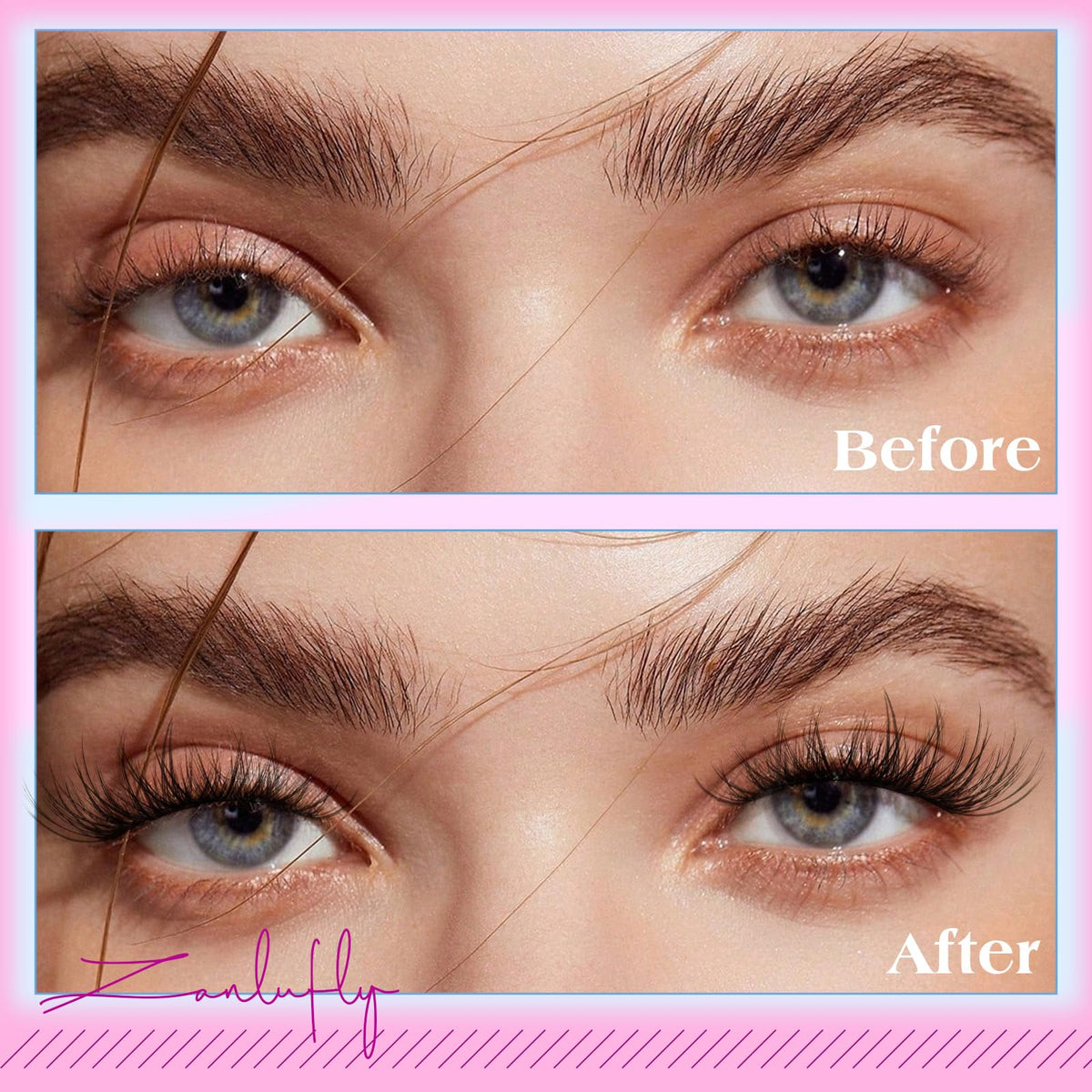 zanlufly before and after eye close-up showing visible enhancement