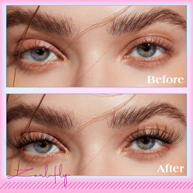 zanlufly before and after eye close-up showing visible enhancement