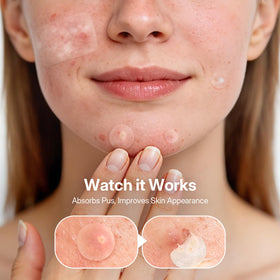 ZATKTK patch applied on cheek demonstrating discreet, protective coverage