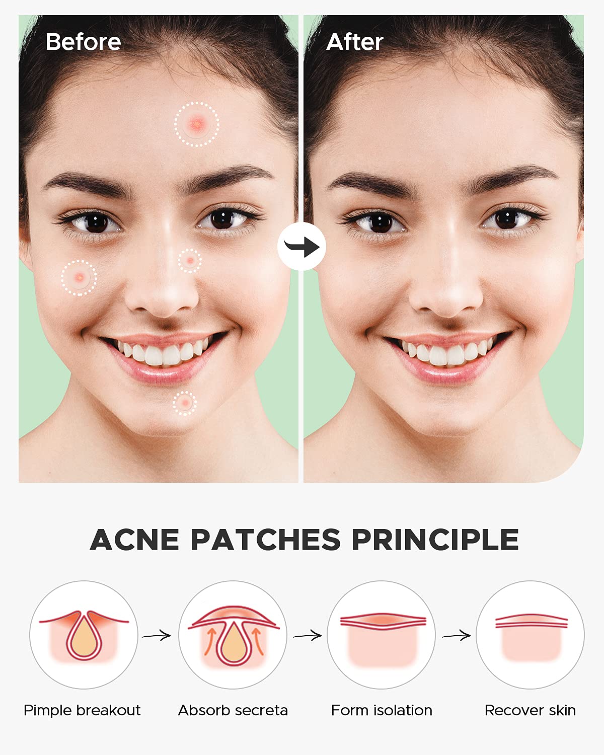 ZATKTK easy-peel backing detail for wrinkle-free patch removal