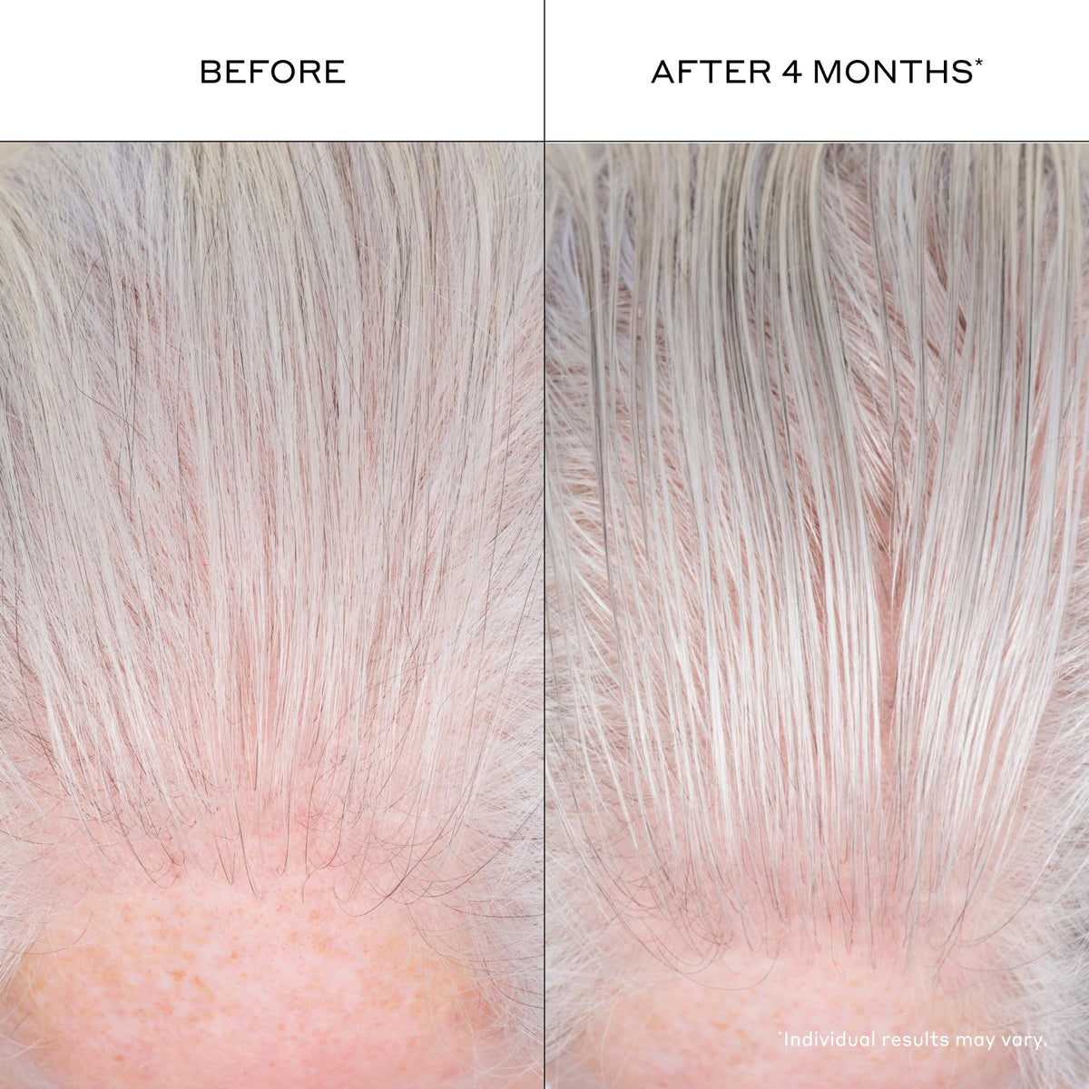 Zenagen in a bathroom routine setting with towel and mirror benefit: integrates smoothly into daily grooming