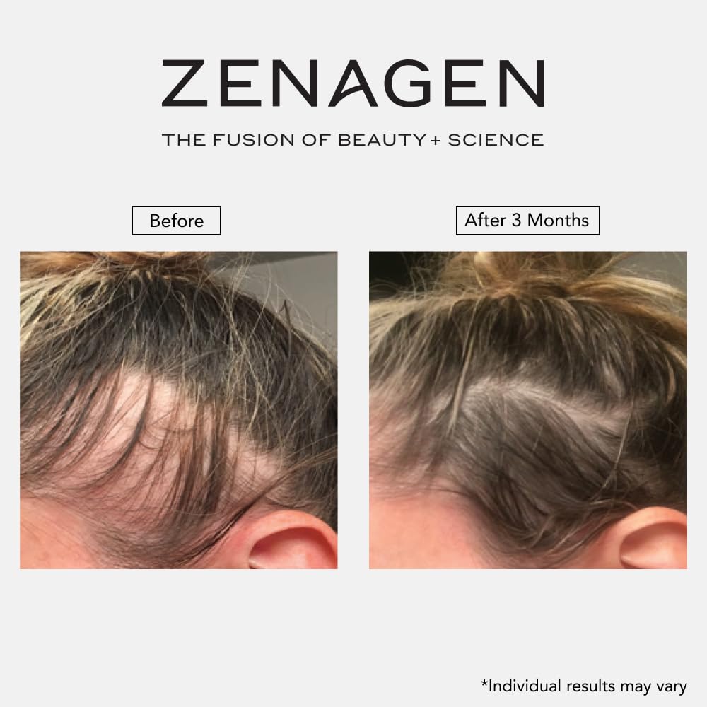 Zenagen botanical extracts used in Revolve highlighting concentrated actives benefit