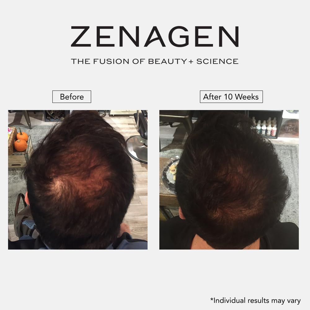 Zenagen Revolve paired with conditioner showing recommended combination for fuller-looking hair
