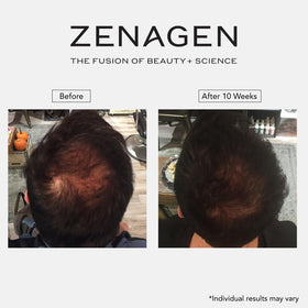 Zenagen Revolve paired with conditioner showing recommended combination for fuller-looking hair