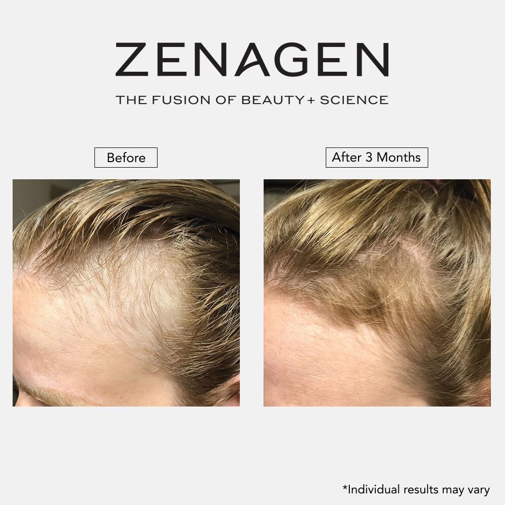 Zenagen Revolve bottle staged in bathroom lifestyle for daily routine inspiration