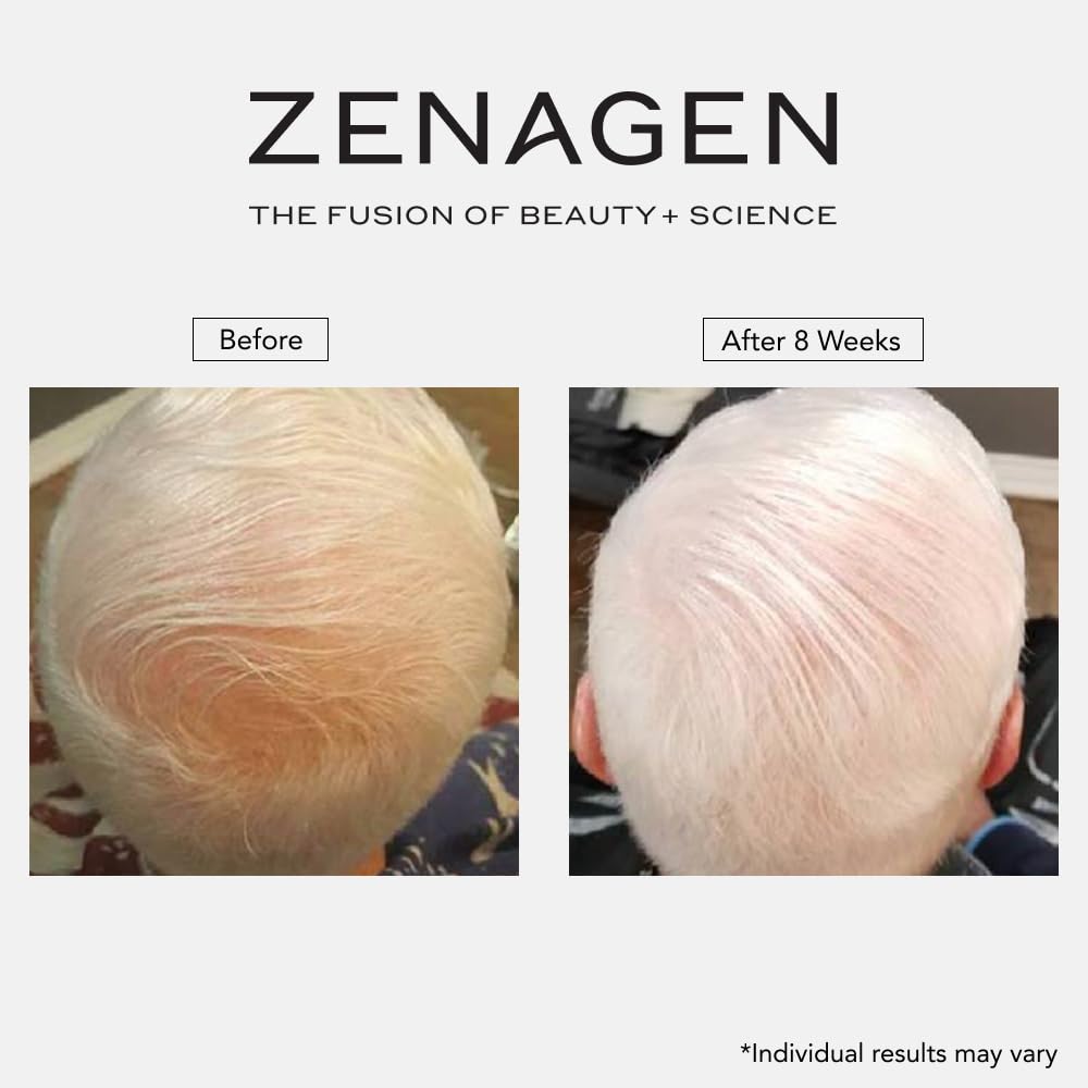 Man applying Zenagen Revolve shampoo in bathroom illustrating simple application benefits