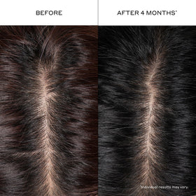 Zenagen serum visibly absorbing into scalp close-up benefit: non-greasy finish and quick drying