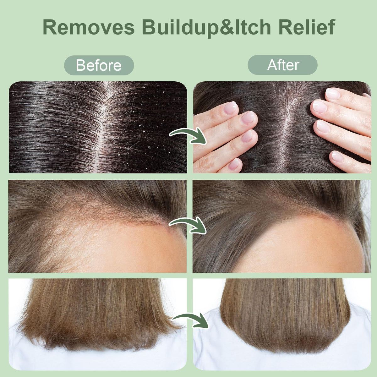 ZENGYQI applying scrub to wet scalp for deep cleansing