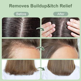 ZENGYQI applying scrub to wet scalp for deep cleansing