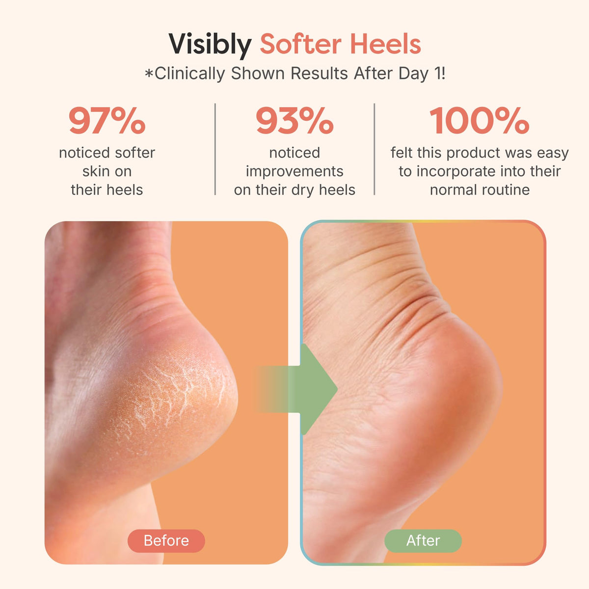 ZenToes open-toe design detail promoting breathable comfort