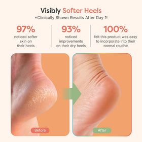 ZenToes open-toe design detail promoting breathable comfort