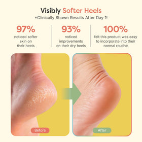 ZenToes open-toe design detail allowing breathability and toe freedom