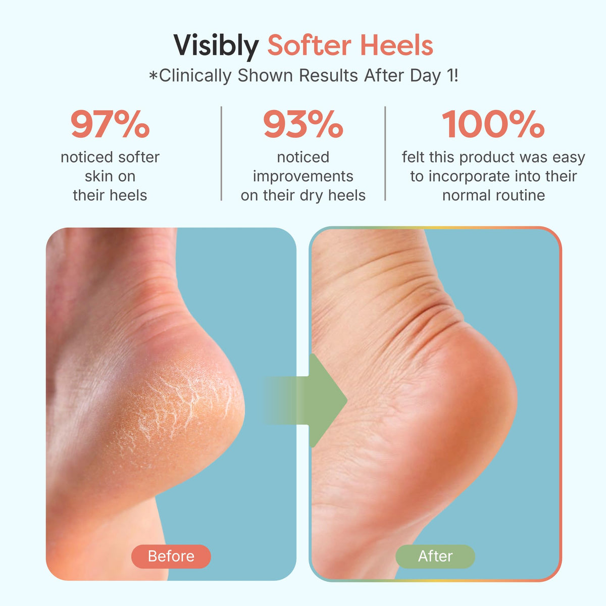 ZenToes open-toe design top view for breathability and comfort