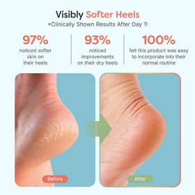 ZenToes open-toe design top view for breathability and comfort