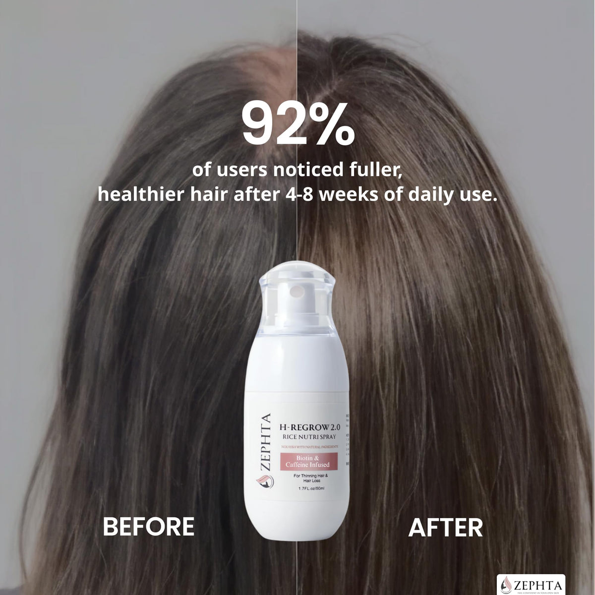 Zephta being applied to a thinning scalp to support hair and follicle care