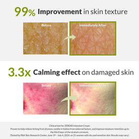 ZEROID cream being applied to hand demonstrating instant comfort and smoothness