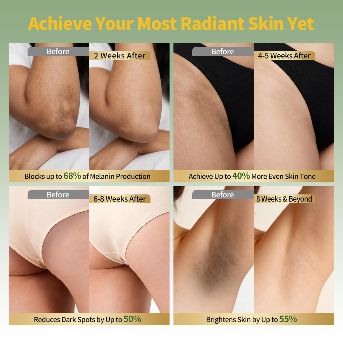 Zestvent applied to bikini line illustrating targeted coverage