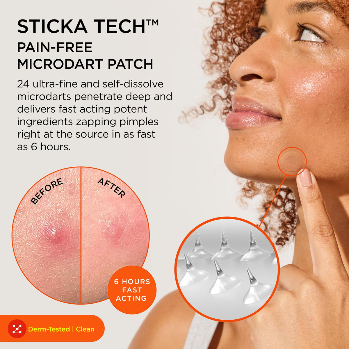 ZitSticka close-up of microdarts illustrating targeted delivery benefit