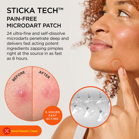 ZitSticka close-up of microdarts illustrating targeted delivery benefit