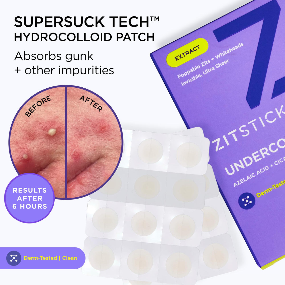 ZitSticka patch under makeup illustrating seamless blending advantage