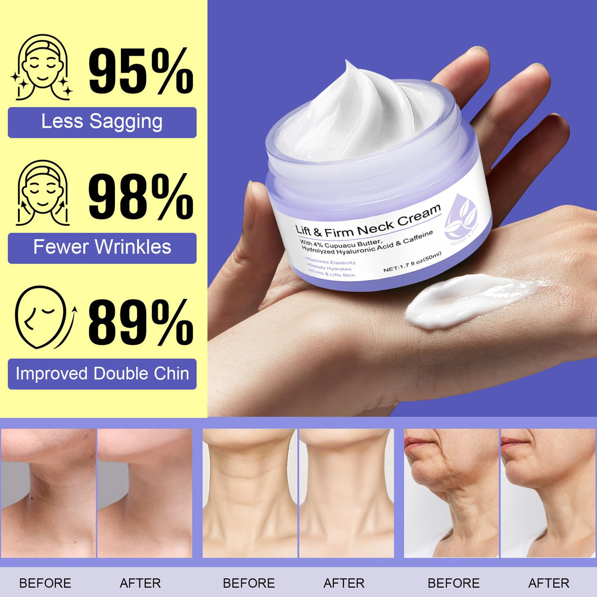 Applying ZIXAOK to décolletage and chest to show multi-area application benefits