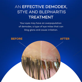 Zocular pad removing eye makeup illustrating effective residue removal and comfort