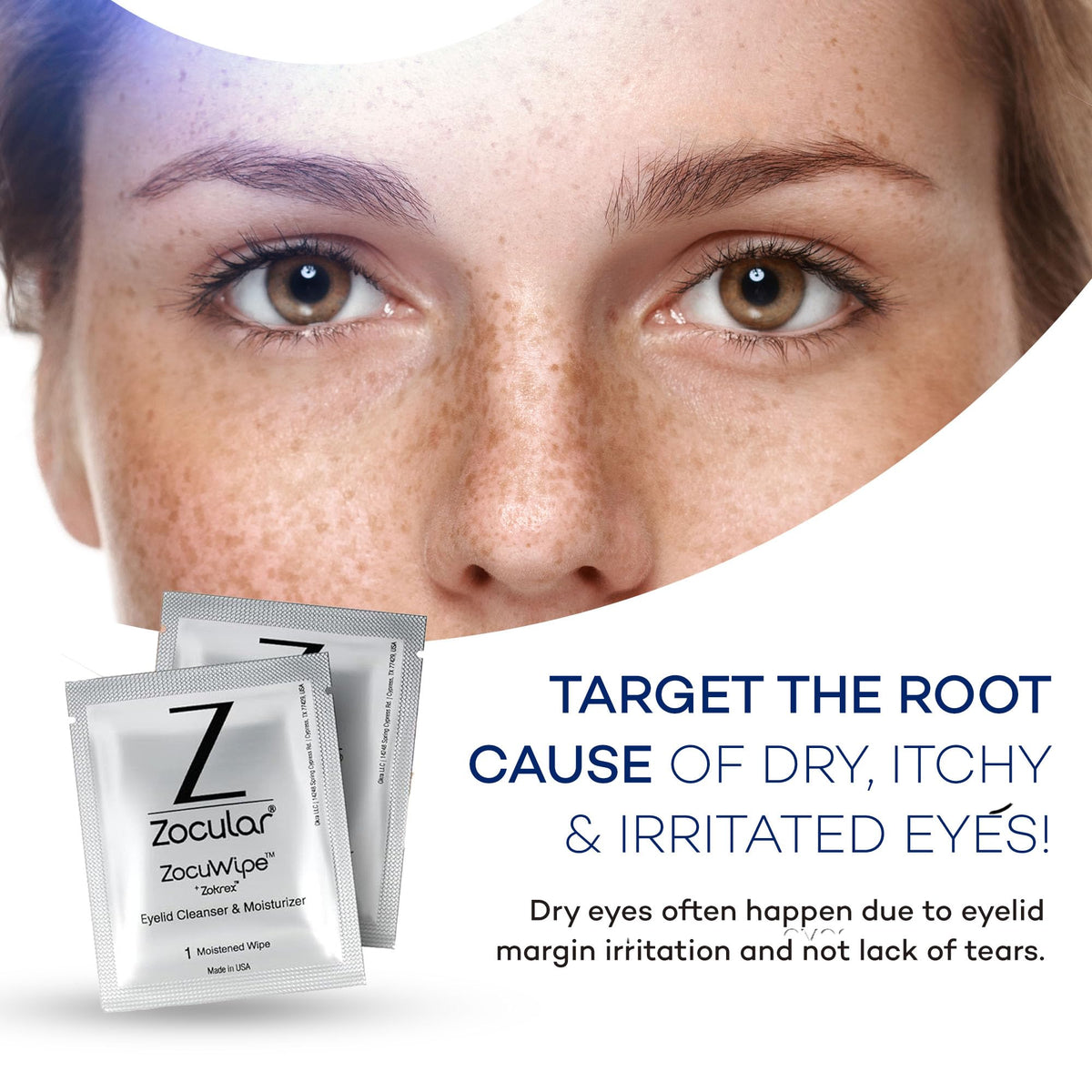 Zocular single pre-moistened wipe closeup for gentle eyelid cleansing